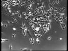 Normal vs Cancer Cells